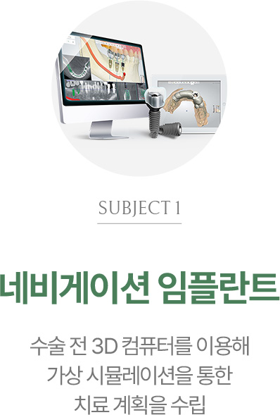 네비게이션 임플란트