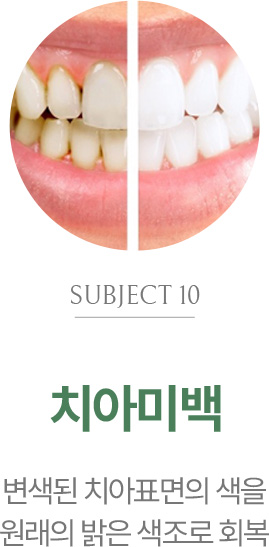 치아미백