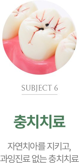 충치치료