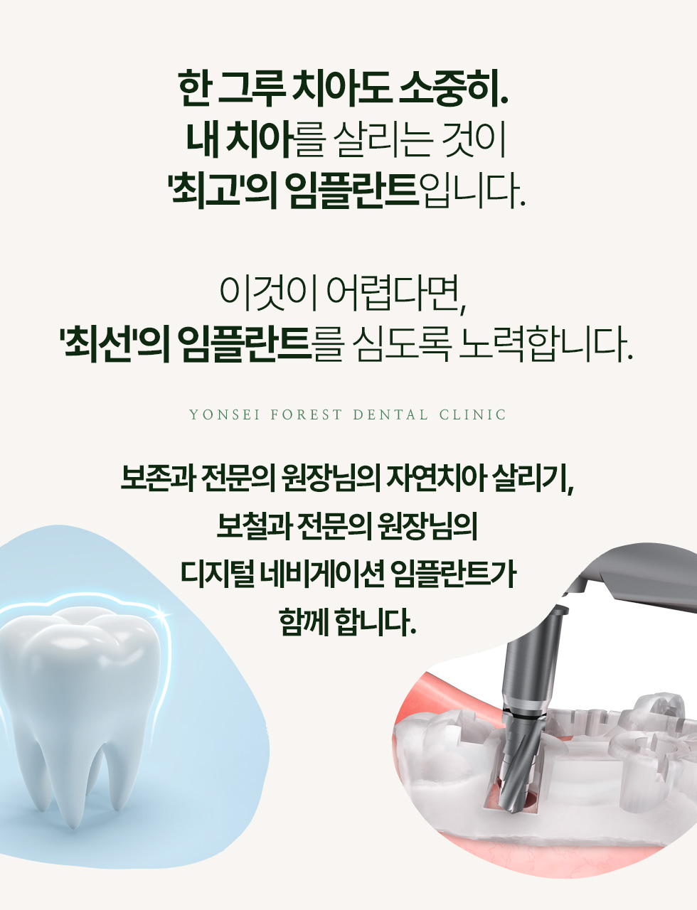 한그루 치아도 소중히. 내 치아를 살리는 것이 '최고'의 임플란트입니다. 이것이 어렵다면, '최선'의 임플란트를 심도록 노력합니다.