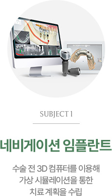 네비게이션 임플란트